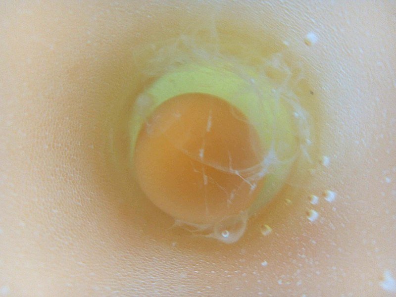 Meaning Of Egg Cleansing: What is this Ritual and How to Interpret Its Readings?